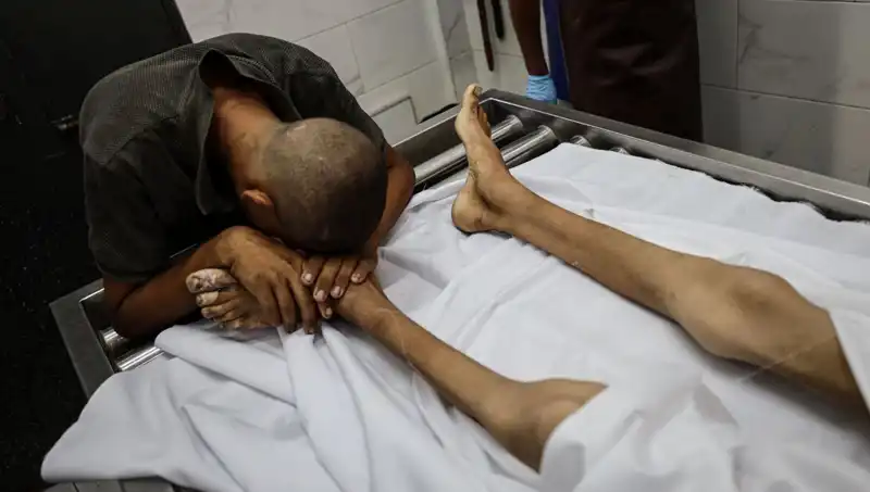 Gazze'de Açlık Kıyımında Bir Çocuk Daha Hayatını Kaybetti: Uluslararası Tepkiler Büyüyor